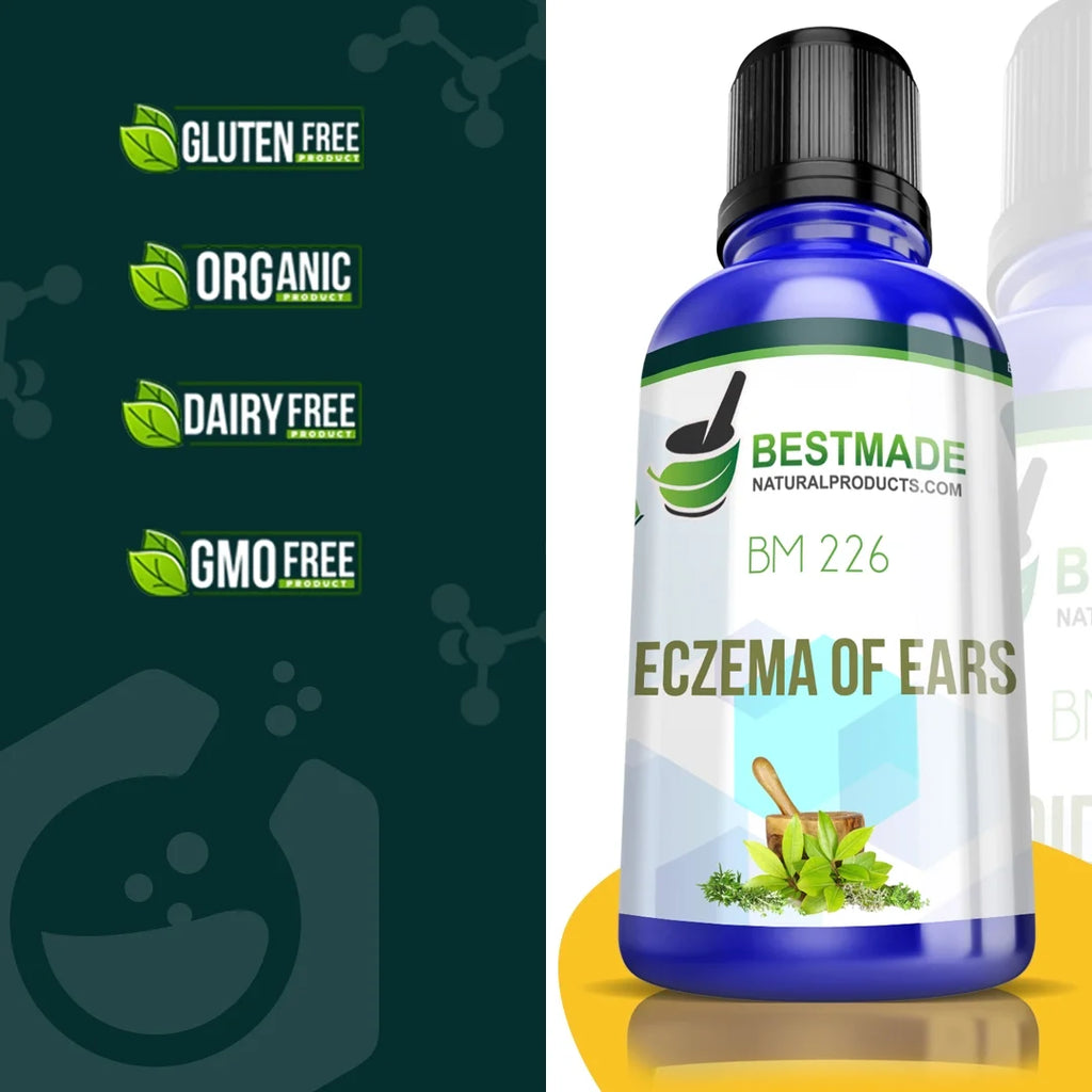 Natural Remedy for Eczema of Ears C20414