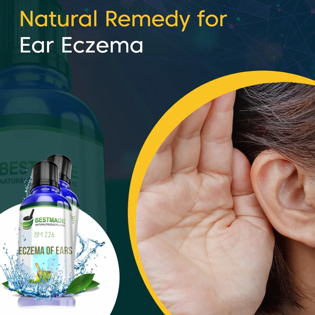 Natural Remedy for Eczema of Ears C20414